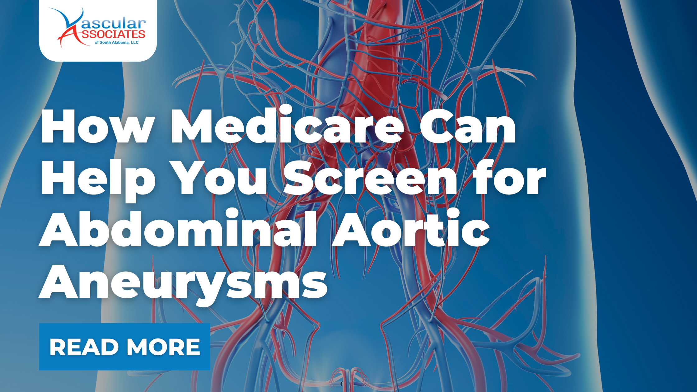 Vascular Blog - How Medicare Can Help You Screen for Abdominal Aortic Aneurysms.png